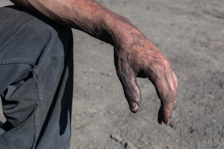 Safe-T-Bulletin | Amputated thumb sees steel company fined $30K